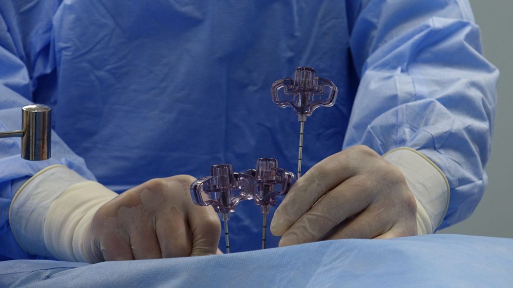 Salle d’angiographie où se pratique la thrombectomie mécanique du caillot cérébral