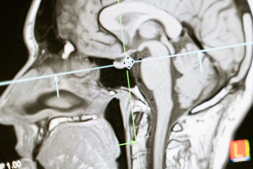 Imagerie et recherche sur le cerveau humain en laboratoire